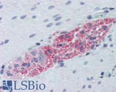 Anti-RPS6KB1 / P70S6K / S6K Antibody (clone 1E12) IHC-plus LS-B6145