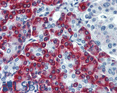 Anti-SSR1 Antibody (clone 1A12) IHC-plus LS-B6152