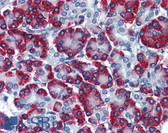 Anti-SSR1 Antibody (clone 1C11) IHC-plus LS-B6153