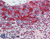 Anti-STAT6 Antibody (clone 6C10) IHC-plus LS-B6154
