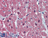 Anti-TNNC1 / Cardiac Troponin C Antibody (clone 1F8-A9) IHC-plus LS-B6157