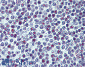 Anti-UBTF / UBF Antibody (clone 1A2) IHC-plus LS-B6166