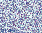 Anti-UBTF / UBF Antibody (clone 2D8) IHC-plus LS-B6167