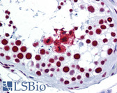Anti-SRSF3 / SRP20 Antibody (aa111-160) IHC-plus LS-B6172