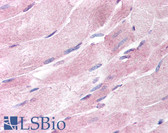 Anti-ADIPOR1/Adiponectin Receptor 1 Antibody IHC-plus LS-B15