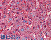 Anti-ALB / Serum Albumin Antibody IHC-plus LS-B6178