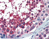 Anti-US01 / p115 Antibody (clone 3F4) IHC-plus LS-B6185