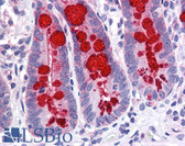 Anti-SLC9A3R1 / NHERF1 / EBP50 Antibody (clone 2B7) IHC-plus LS-B6196
