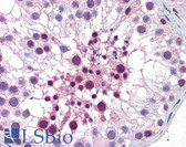 Anti-MED26 / CRSP7 Antibody (clone 2G10) IHC-plus LS-B6198