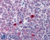 Anti-ESPL1 / Separase Antibody (clone 6H6) IHC-plus LS-B6199