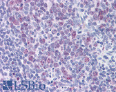 Anti-HDAC4 Antibody (clone 2B11) IHC-plus LS-B6200