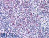 Anti-HDAC4 Antibody (clone 2B11) IHC-plus LS-B6200