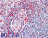 Anti-MVP / VAULT1 Antibody (clone 2H3-1A6) IHC-plus LS-B6201