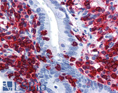 Anti-CORO1A / Coronin 1a Antibody (clone 4G10) IHC-plus LS-B6211