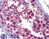 Anti-STK38 Antibody (clone 6F1) IHC-plus LS-B6231