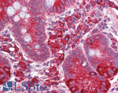 Anti-HSPA5 / GRP78 / BiP Antibody (Internal, clone EPR4040(2)) IHC-plus LS-B6241