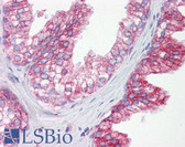 Anti-CDC25B Antibody (Internal, clone EPR3459(2)) IHC-plus LS-B6243