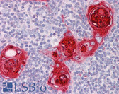 Anti-CXCR6 Antibody (C-Terminus) IHC-plus LS-B6246