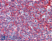 Anti-NOX2 / gp91phox Antibody (clone 48) IHC-plus LS-B6247