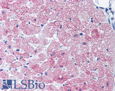 Anti-SLC2A4 / GLUT-4 Antibody IHC-plus LS-B26