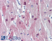 Anti-HSPB6 / HSP20 Antibody IHC-plus LS-B6252