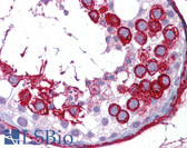 Anti-APCS / Serum Amyloid P / SAP Antibody (clone 6E6) IHC-plus LS-B6259