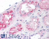 Anti-MTOR Antibody (phospho-Ser2448) IHC-plus LS-B30
