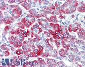 Anti-RPS6 / S6 Antibody (aa191-240) IHC-plus LS-B6278