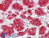 Anti-NPC / NPC1 Antibody (C-Terminus, clone EPR5209) IHC-plus LS-B6281