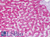 Anti-ACAT1 Antibody (aa221-270) IHC-plus LS-B6286