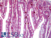 Anti-TBR1 Antibody IHC-plus LS-B6300