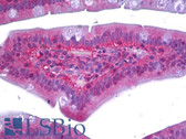 Anti-RAC1 Antibody IHC-plus LS-B6306