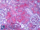 Anti-TNFRSF12A / FN14 Antibody (Internal, clone EPR3179) IHC-plus LS-B6309