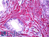 Anti-Filamin Antibody (N-Terminus) IHC-plus LS-B6314