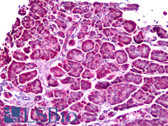 Anti-VHL / Von Hippel Lindau Antibody (clone Ig33) IHC-plus LS-B6316