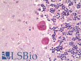 Anti-MAPK15 / ERK7 Antibody IHC-plus LS-B6317
