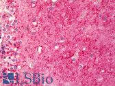 Anti-ENO2 / NSE Antibody (aa371-420) IHC-plus LS-B6318