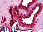 Anti-B3GAT1 Antibody IHC-plus LS-B6322