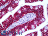 Anti-CLDN1 / Claudin 1 Antibody (aa162-211) IHC-plus LS-B6327