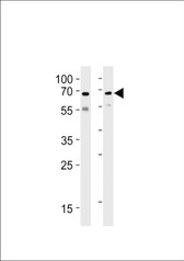 Anti-UBQLN1 / Ubiquilin Antibody (N-Terminus) IHC-plus LS-B6344