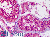 Anti-UBE1L2 / UBE1L2 Antibody (clone 1D11) IHC-plus LS-B6351
