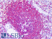 Anti-RICTOR Antibody (clone 1F3) IHC-plus LS-B6357