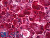 Anti-Osteoprotegerin / OPG Antibody IHC-plus LS-B6363