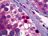 Anti-PDPK1 Antibody IHC-plus LS-B6365