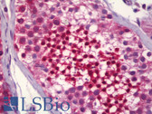 Anti-HSP70 / Heat Shock Protein 70 Antibody IHC-plus LS-B6367
