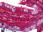Anti-CNR2 / CB2 Antibody IHC-plus LS-B6368