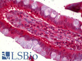 Anti-ACAT1 Antibody IHC-plus LS-B6369