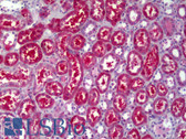 Anti-ATP6V1B2 Antibody (clone 2A5) IHC-plus LS-B6383
