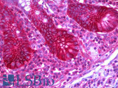 Anti-SLC12A2 / NKCC1 Antibody (clone 5H7) IHC-plus LS-B6385