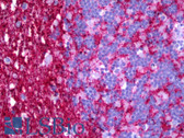 Anti-VDAC1 / PORIN Antibody (clone 2A8) IHC-plus LS-B6394